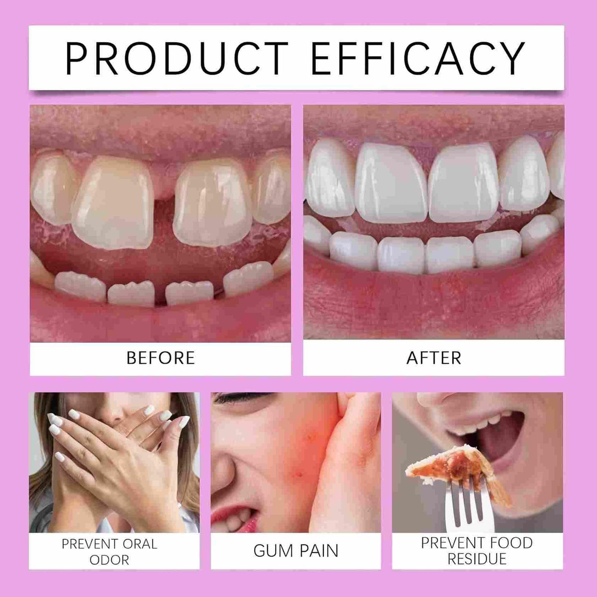 Adjustable Silicone Full-Mouth Denture Set Z800620